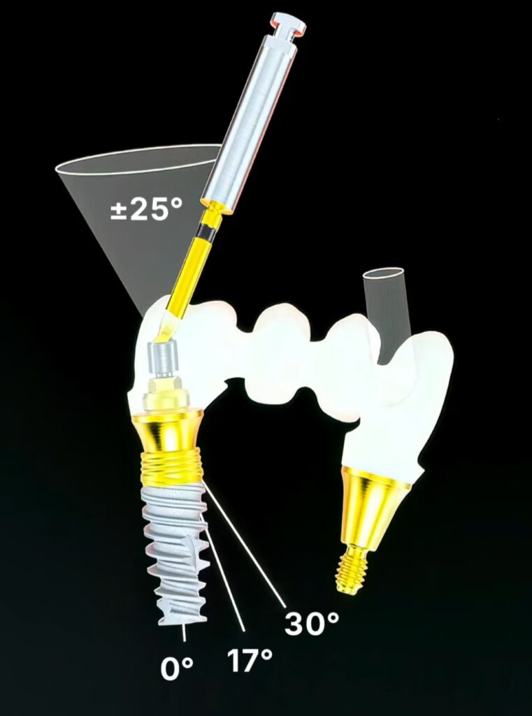 Dental angled screw