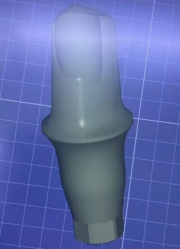Exocad design custom dental abutment